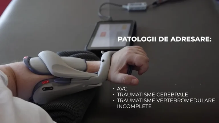 Orteza care ajută pacienții să reînvețe să își miște mâna paralizată în urma AVC sau a unor traumatisme ale coloanei vertebrale 4 Orteza care ajută pacienții să reînvețe să își miște mâna paralizată în urma AVC sau a unor traumatisme ale coloanei vertebrale
